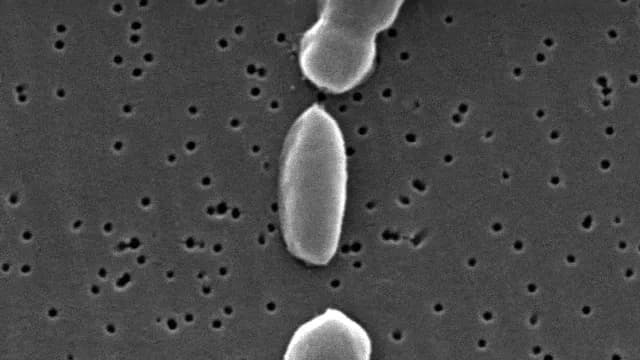 Bacterias bajo el microscopio, semejantes a LUCA