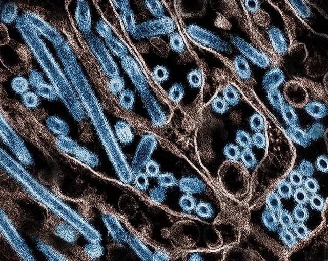 Mutación de la gripe aviar recién descubierta permite contagio a humanos