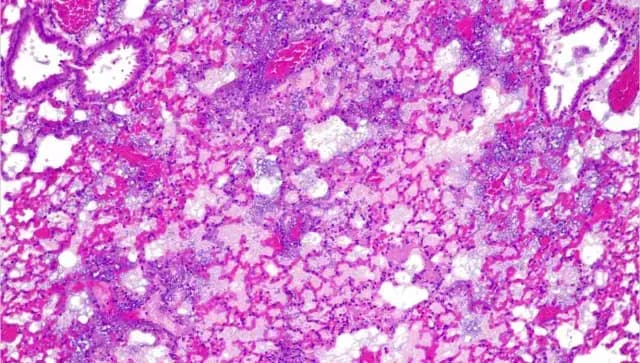 Crean píldora viva que contiene una bacteria modificada capaz de vencer la resistencia a los antibióticos