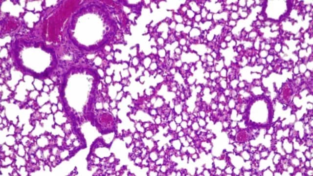 Investigadores desarrollaron una versión modificada de la bacteria mycoplasma pneumoniae