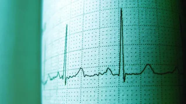 Imagen de un electrocardiograma sobre una hoja