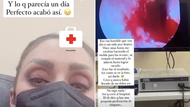 Ahahí en una sala de urgencias por accidente