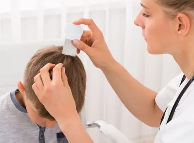 Madre Vegana No Mata los Piojos de su Hija para No Dañarlos