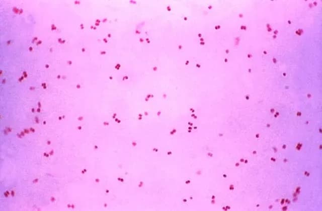 Bacterias de la gonorrea bajo el microscopio