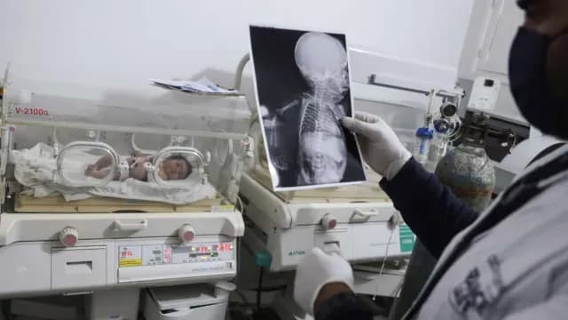 La bebé Aya se encuentra en el hospital Cihan