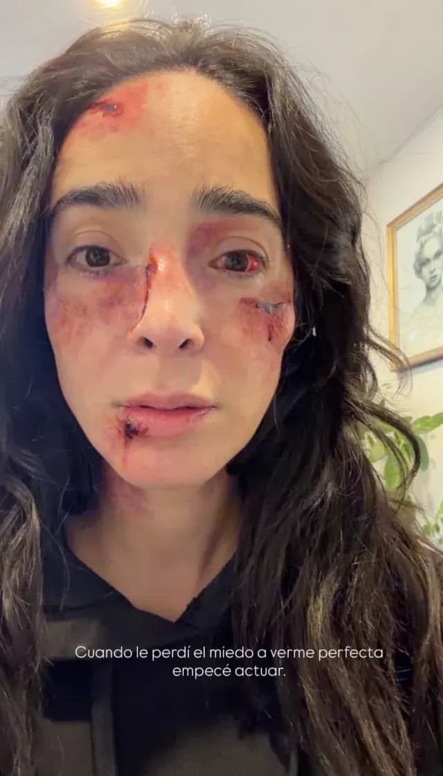 Manelyk subió la foto donde se ve con el rostro golpeado.