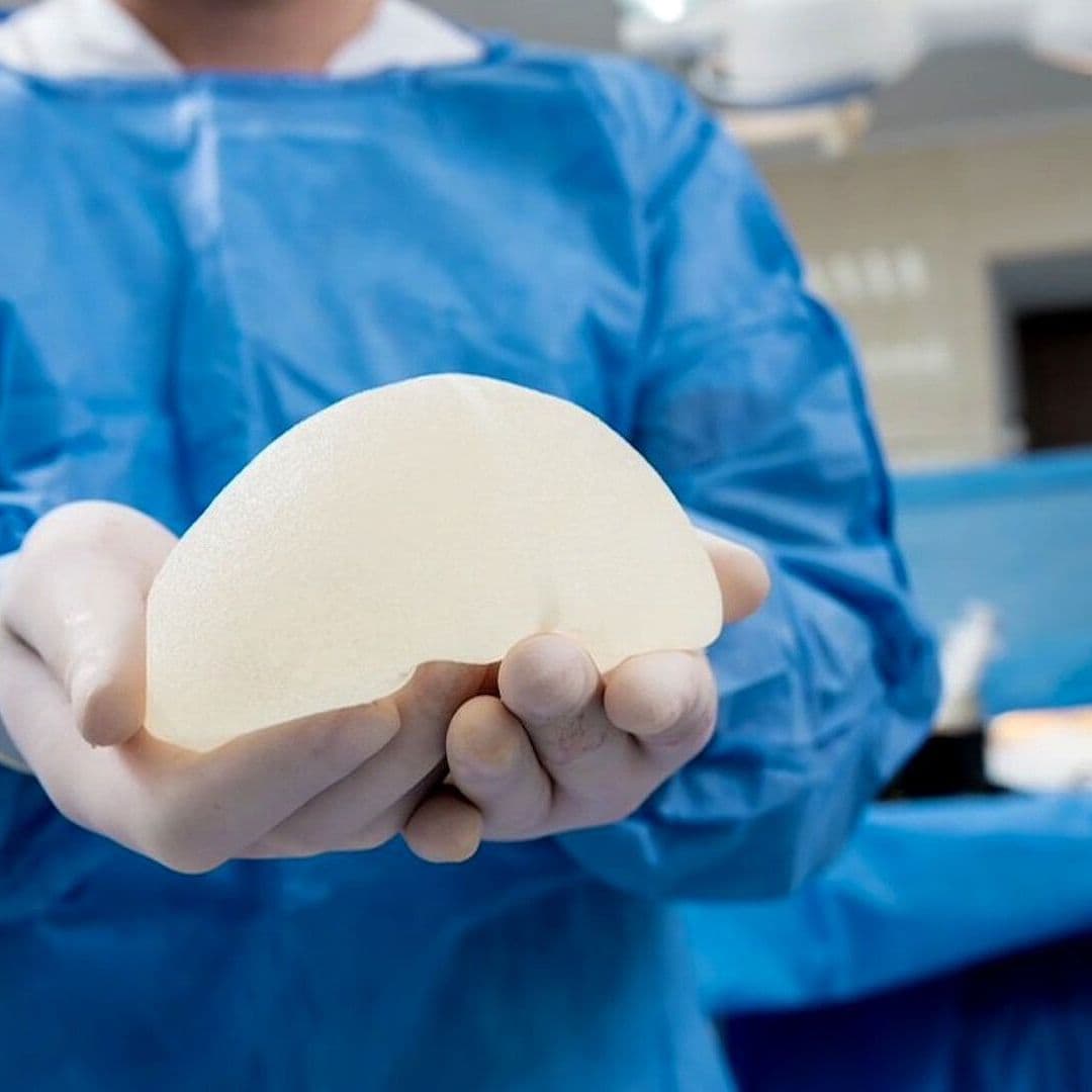 Implantes Mamarios: ¿Son Seguros? Cirujano Explica Riesgos, Edad Ideal y Señales de Alerta