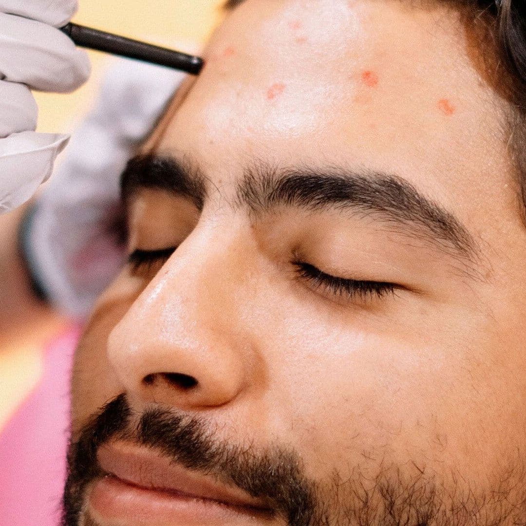 Rejuvenecimiento Facial y Corporal: Estas Son las Nuevas Tendencias con Técnicas Mínimamente Inv