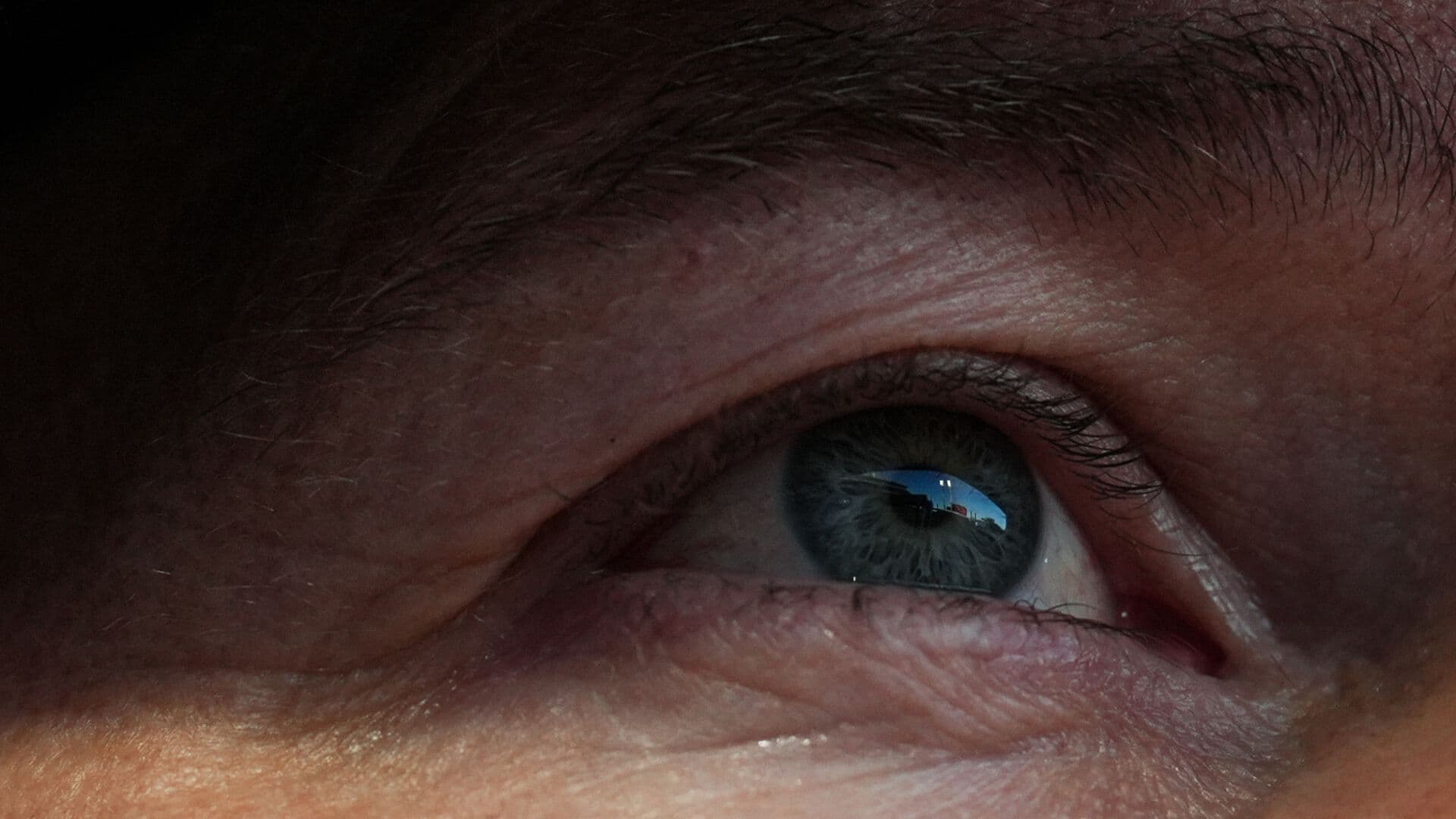 Preocupa Aumento en Casos de Conjuntivitis, Campeche