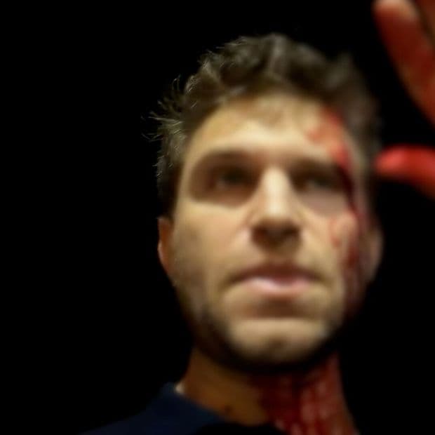 Asaltan al Actor Keegan Allen en West Hollywood