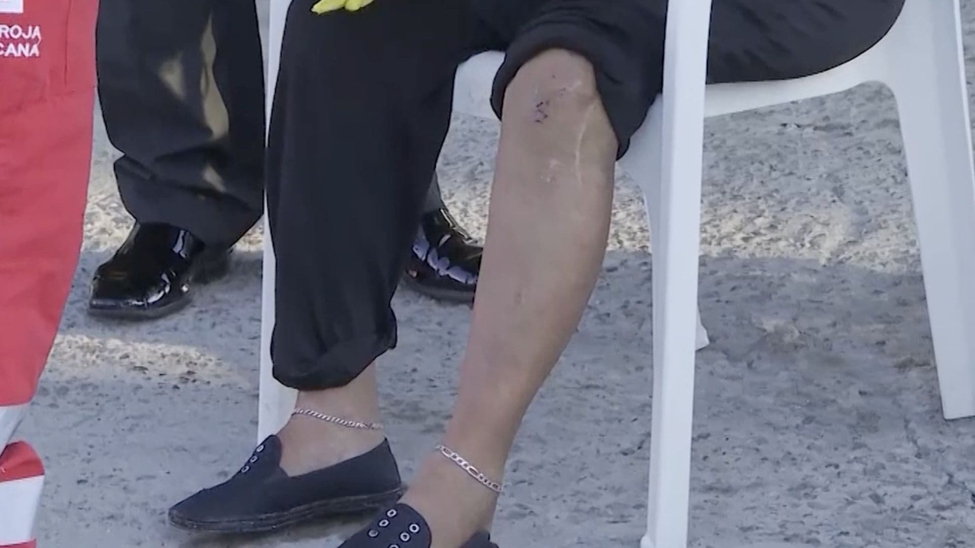 Adulta Mayor Resulta Lesionada tras Resbalar en Charco y Caer de Vehículo Eléctrico en Torreón