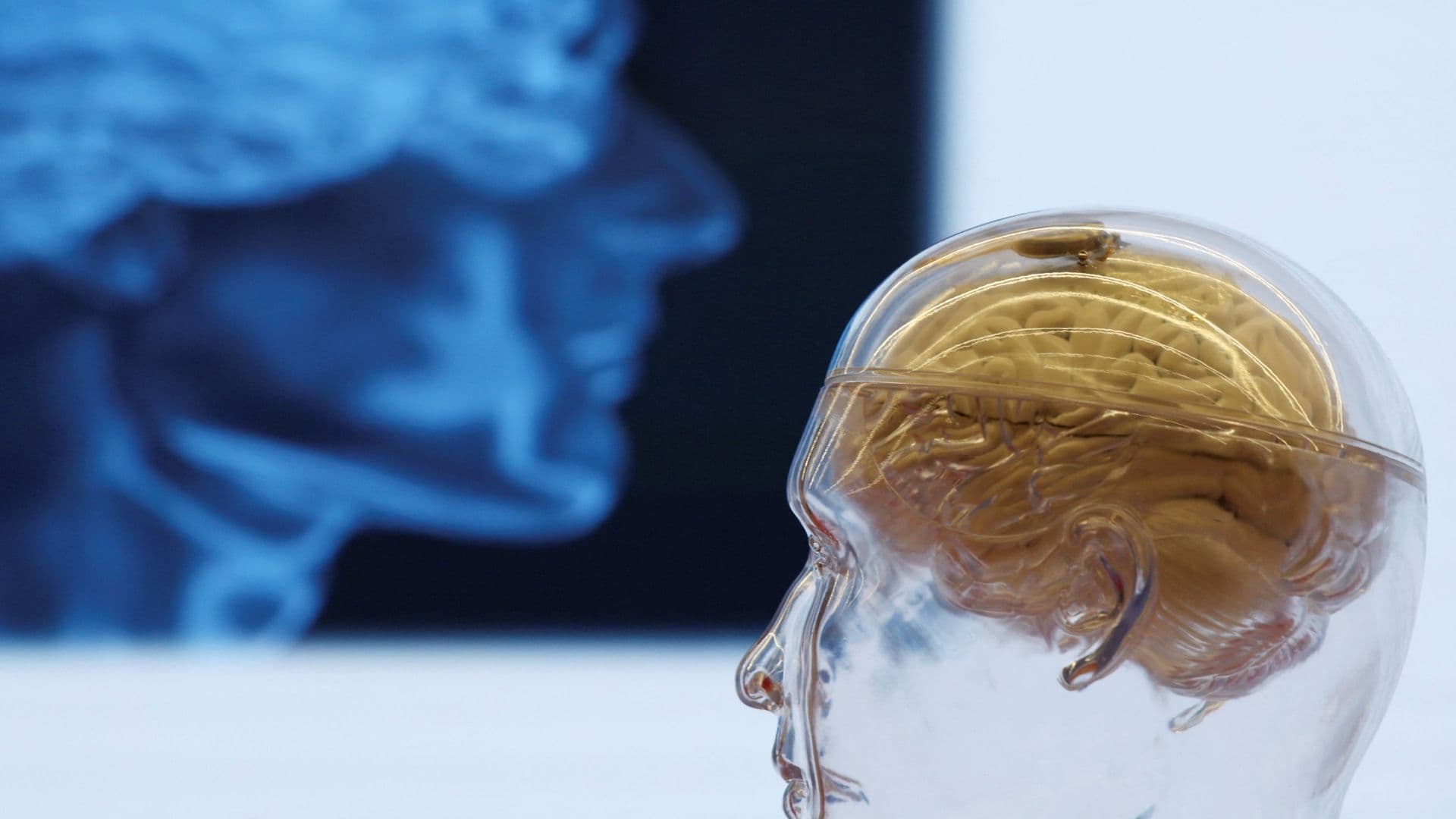 Modelo 3D de un cerebro. Qué es la Materia Gris y Cómo Tener Más