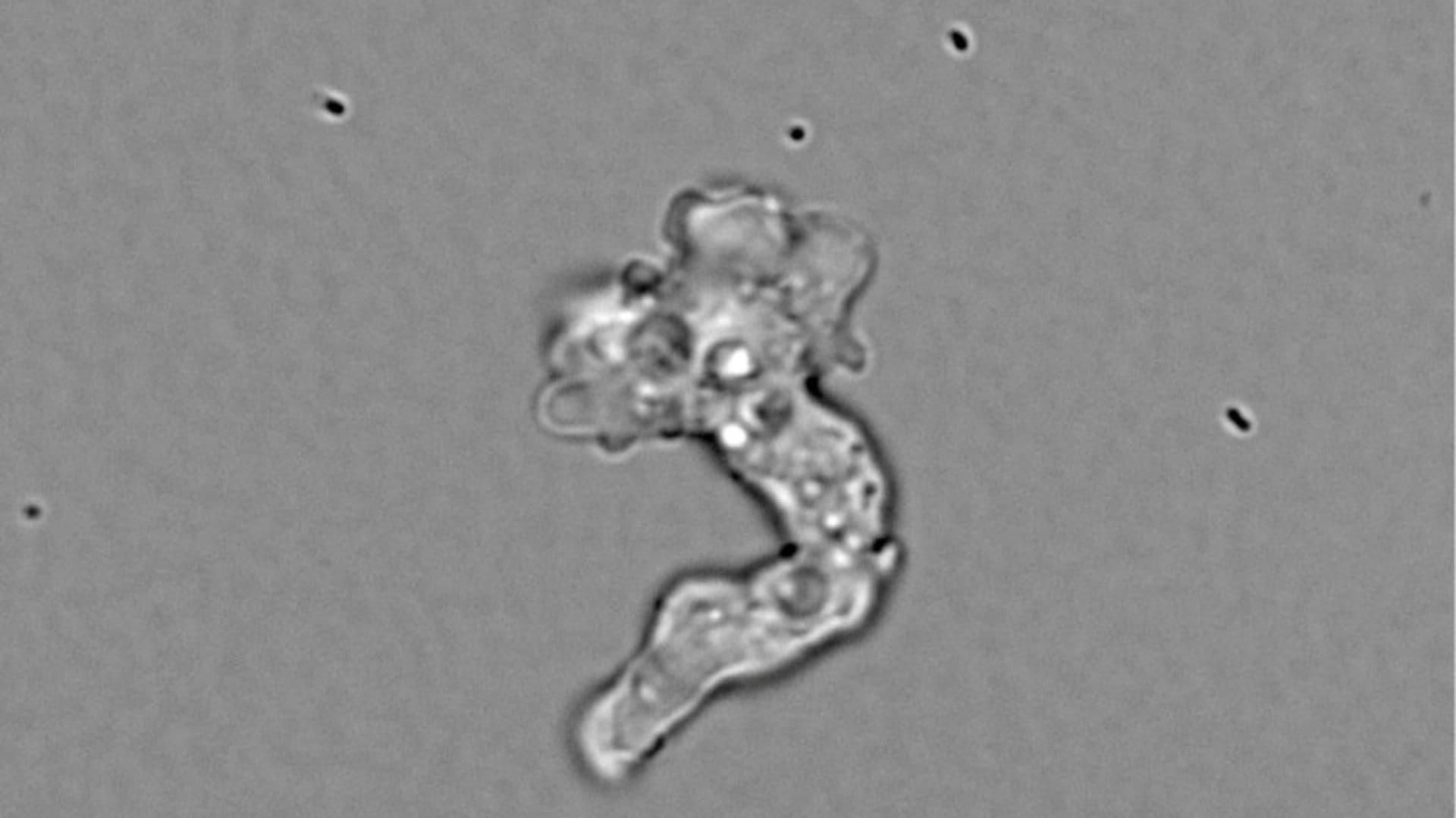 Científica Descubre Dos Nuevas Especies de Ameba en Laboratorio Improvisado en un Motel