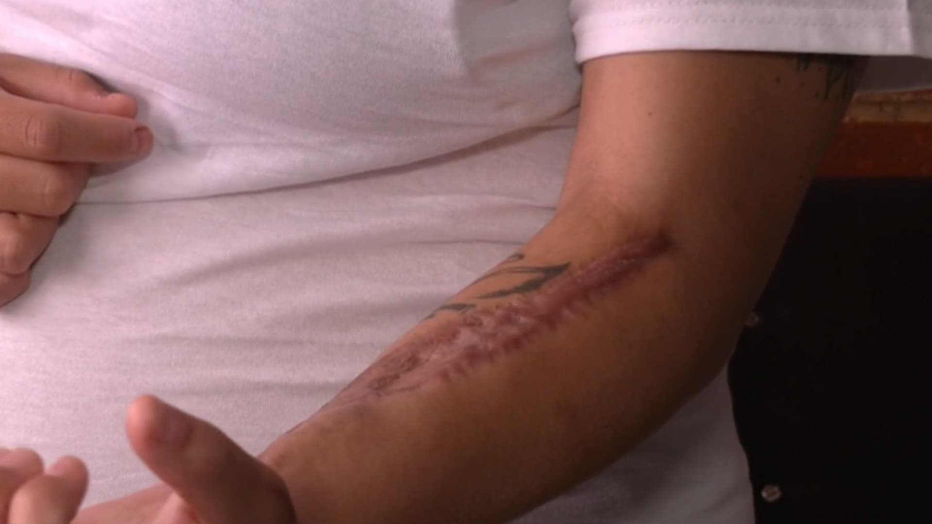 Exige Vianey que Sea Detenida su Expareja, Quien le Disparó en la Cara con una Pistola